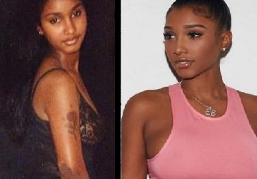 A picture of Bernice Brugos before (left) and after plastic surgery (right).